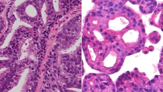 especialistas en cáncer de próstata de milán especialistas en cáncer de próstata de milán